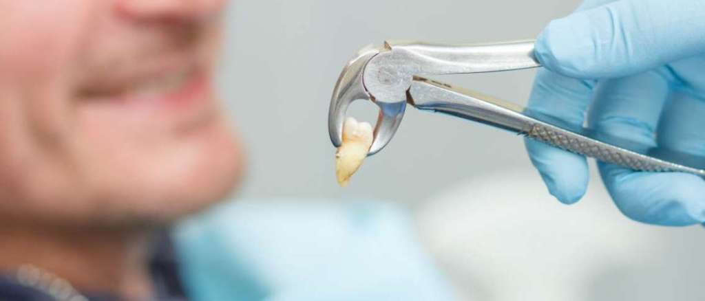 Tips Cabut Gigi Penderita Diabetes agar&nbsp;Aman